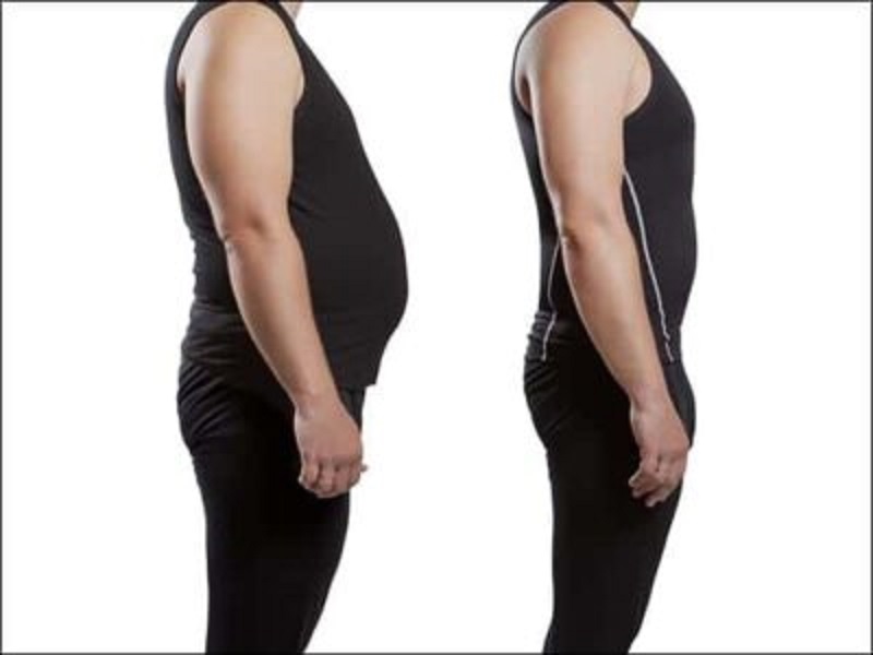 Weight loss treatment in Chennai